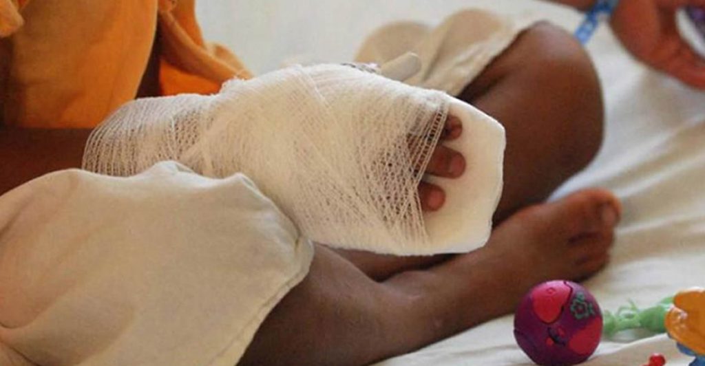 Procuraduría pide fortalecer estrategias para prevenir niños lesionados con pólvora durante halloween y festividades de fin de año